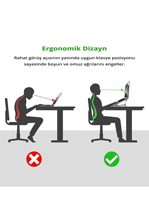Juo Rabbit Alüminyum Portatif Notebook ve Tablet Standı - OUTLET