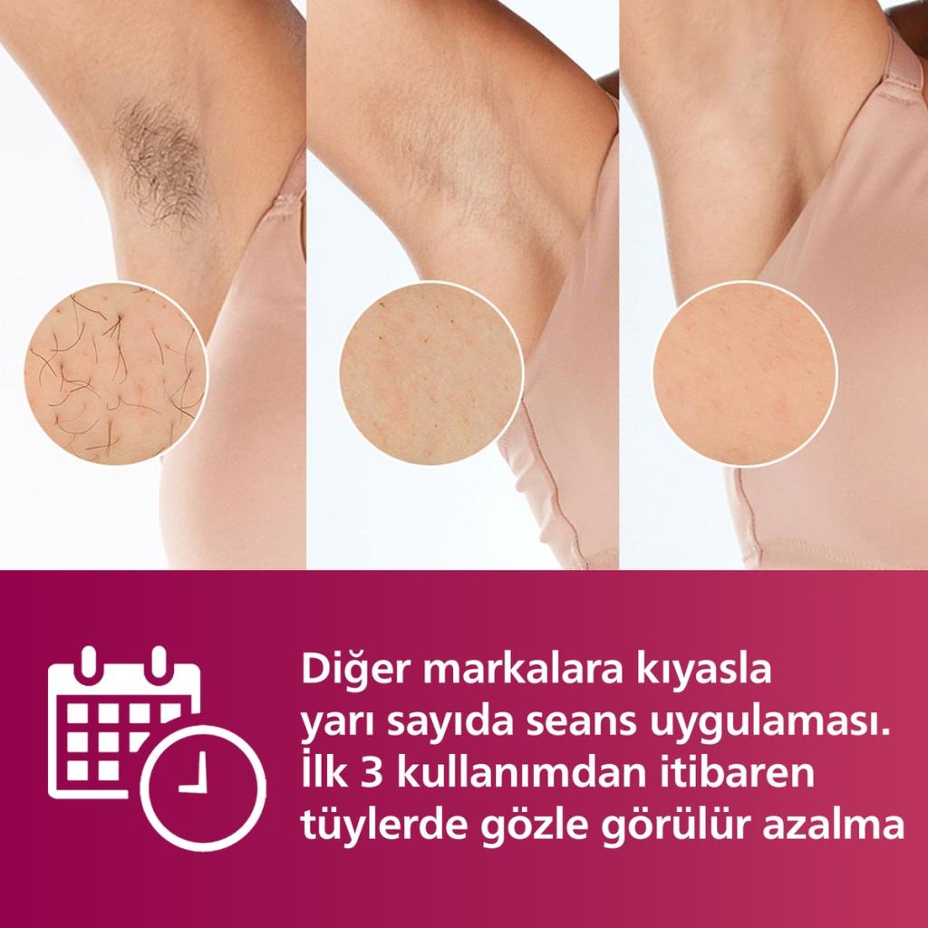 Philips Lumea Advanced BRI924/00 IPL Lazer Epilasyon Aleti - TEŞHİR